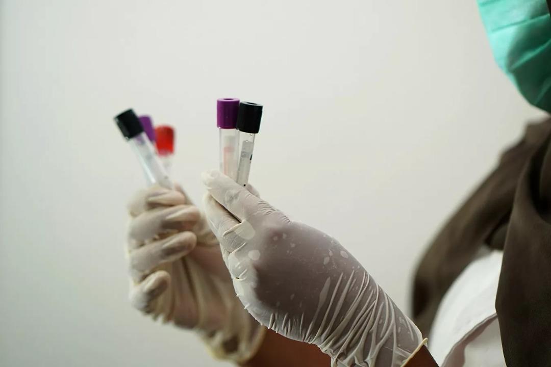 Rusia exige explicaciones a EEUU sobre sus laboratorios biológicos en Ucrania
