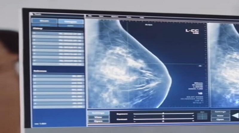Venezuela cuenta con software que detecta el cáncer de mama y tiroides