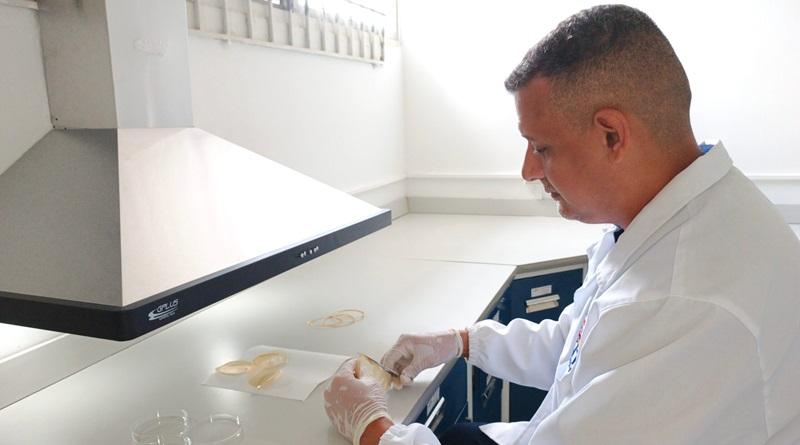 Científicos zulianos desarrollan apósitos biocompatibles para quemaduras